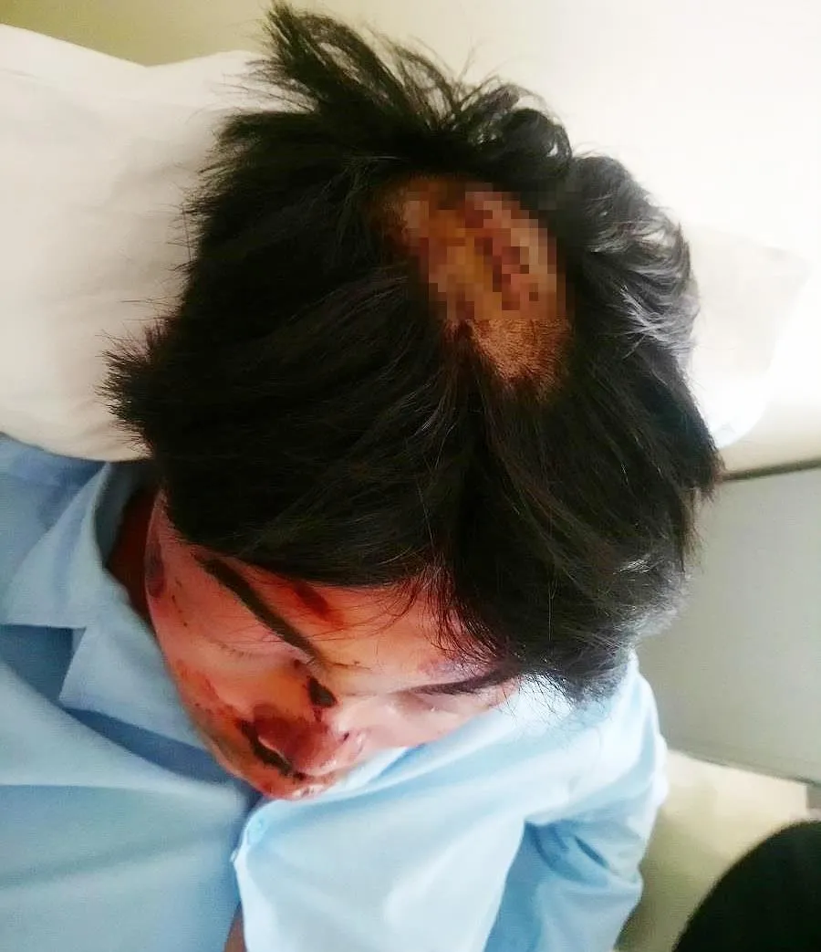 Một học sinh lớp 11 tố bị bạn cùng trường dùng dao chém toạc đầu ảnh 1