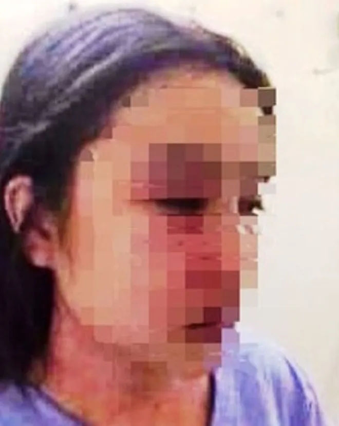 Nữ điều dưỡng phải nhập viện cấp cứu sau bị bác sĩ P. gạ tình, hành hung.