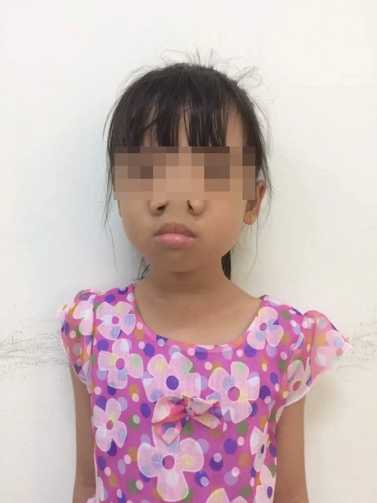 Chữa thành công cho bé gái mắc dị tật hiếm gặp trên thế giới ảnh 2