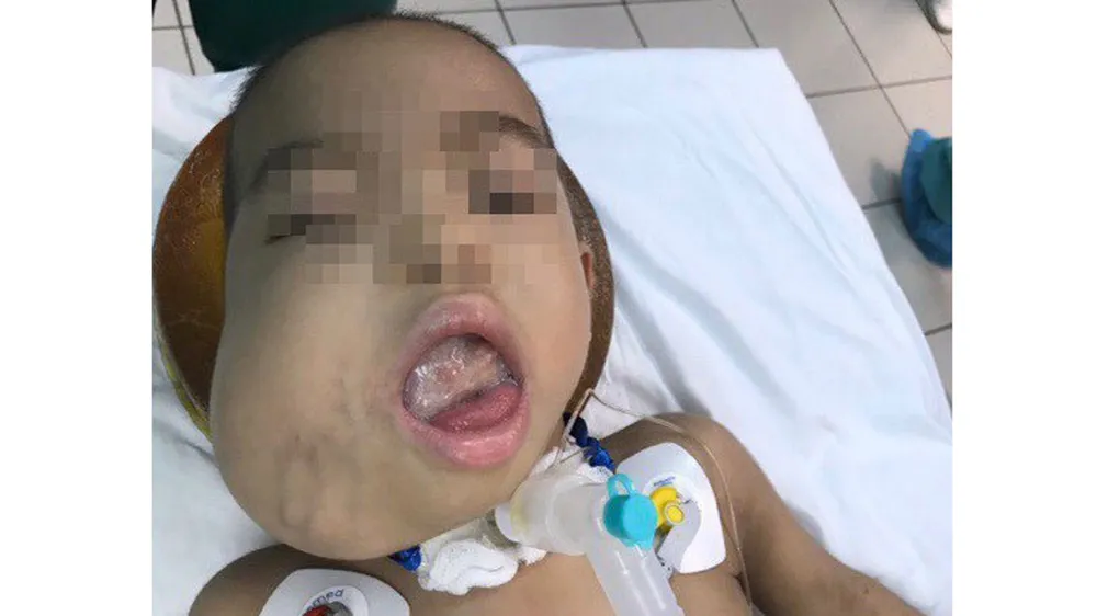 Bệnh nhân Ng. trước khi phẫu thuật