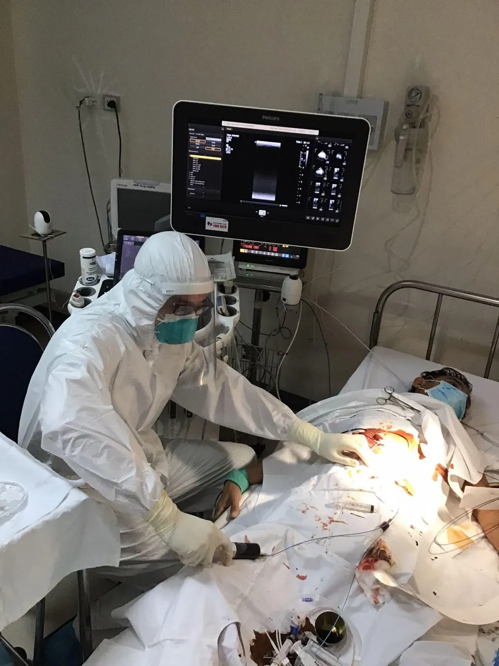 Bệnh viện Trung ương Huế cơ sở 2 đang tích cực điều trị cho 6 bệnh nhân mắc Covid-19 còn lại ảnh 4