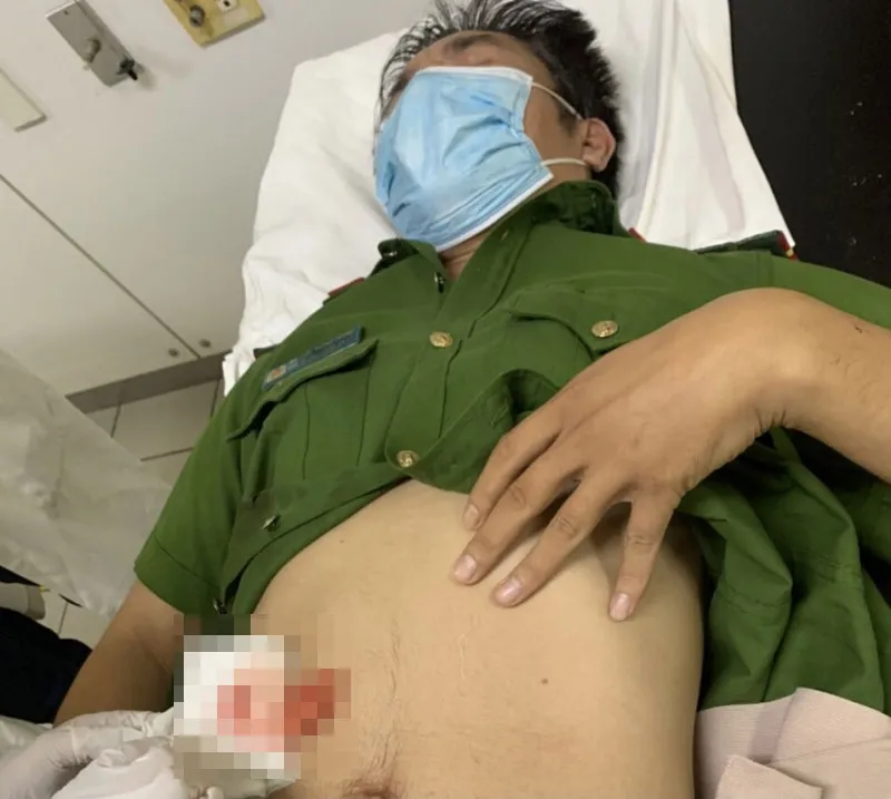 Khởi tố bị can đâm trọng thương phó công an xã  ảnh 1