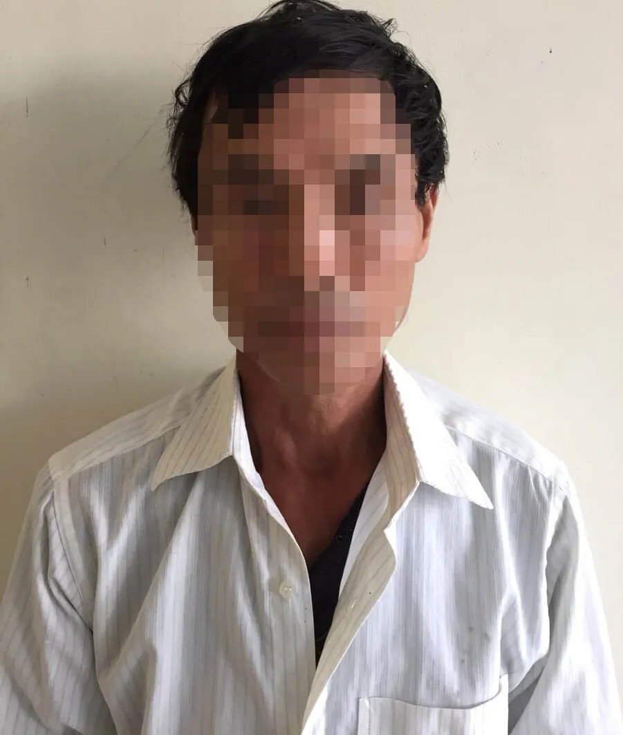 Đi thể dục buổi sáng làm chó sủa, cụ ông 83 tuổi bị đánh gãy 2 tay ảnh 1