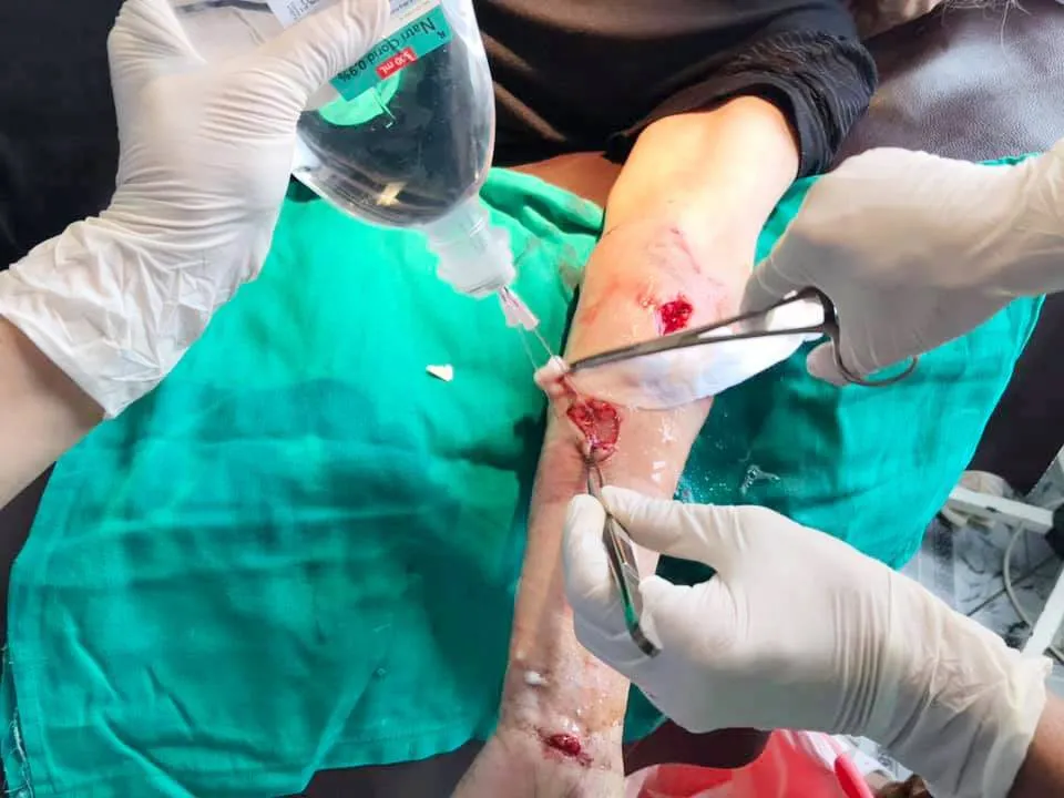 Cụ bà bị 30 vết thương do chó berger cắn phải nhập viện ảnh 1