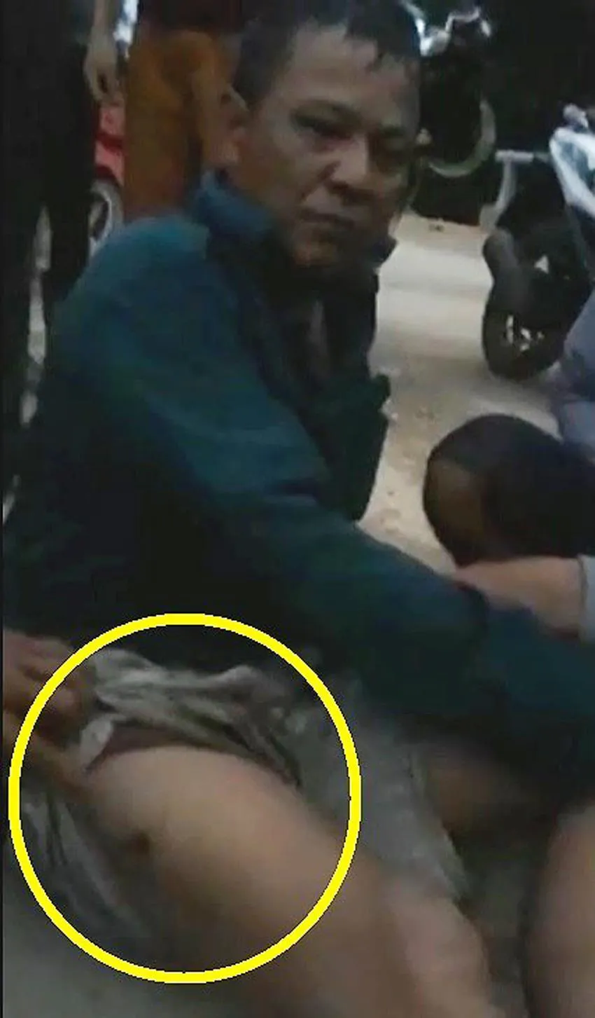 Một trưởng thôn bị bắn trọng thương ảnh 1