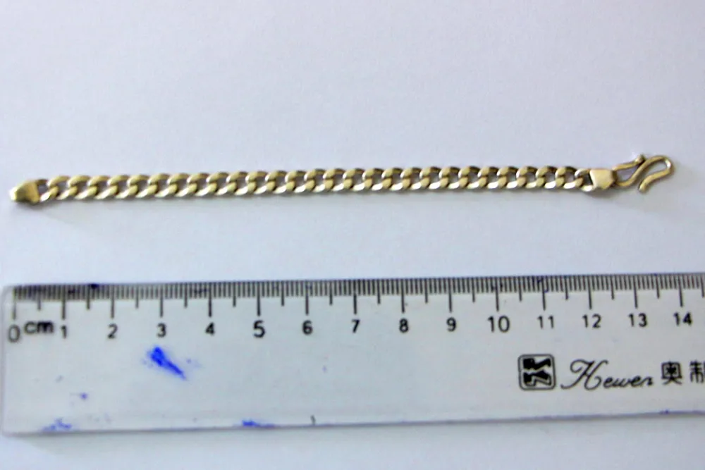 Gắp sợi dây chuyền bạc dài 14cm trong khí phế quản của bệnh nhi 28 tháng tuổi ảnh 2