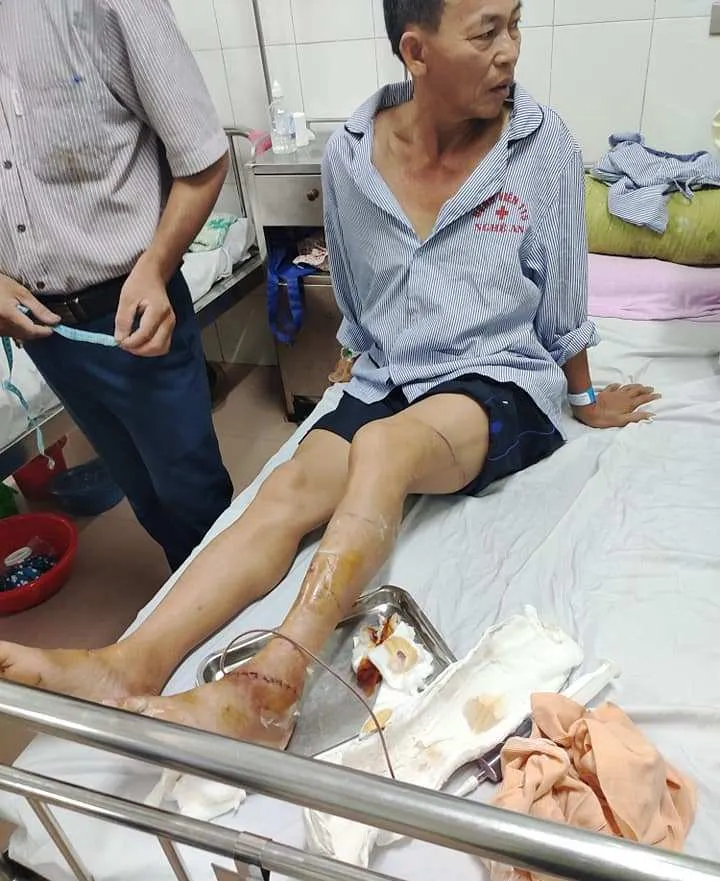 Bắt khẩn cấp đối tượng chém công an viên  ảnh 1