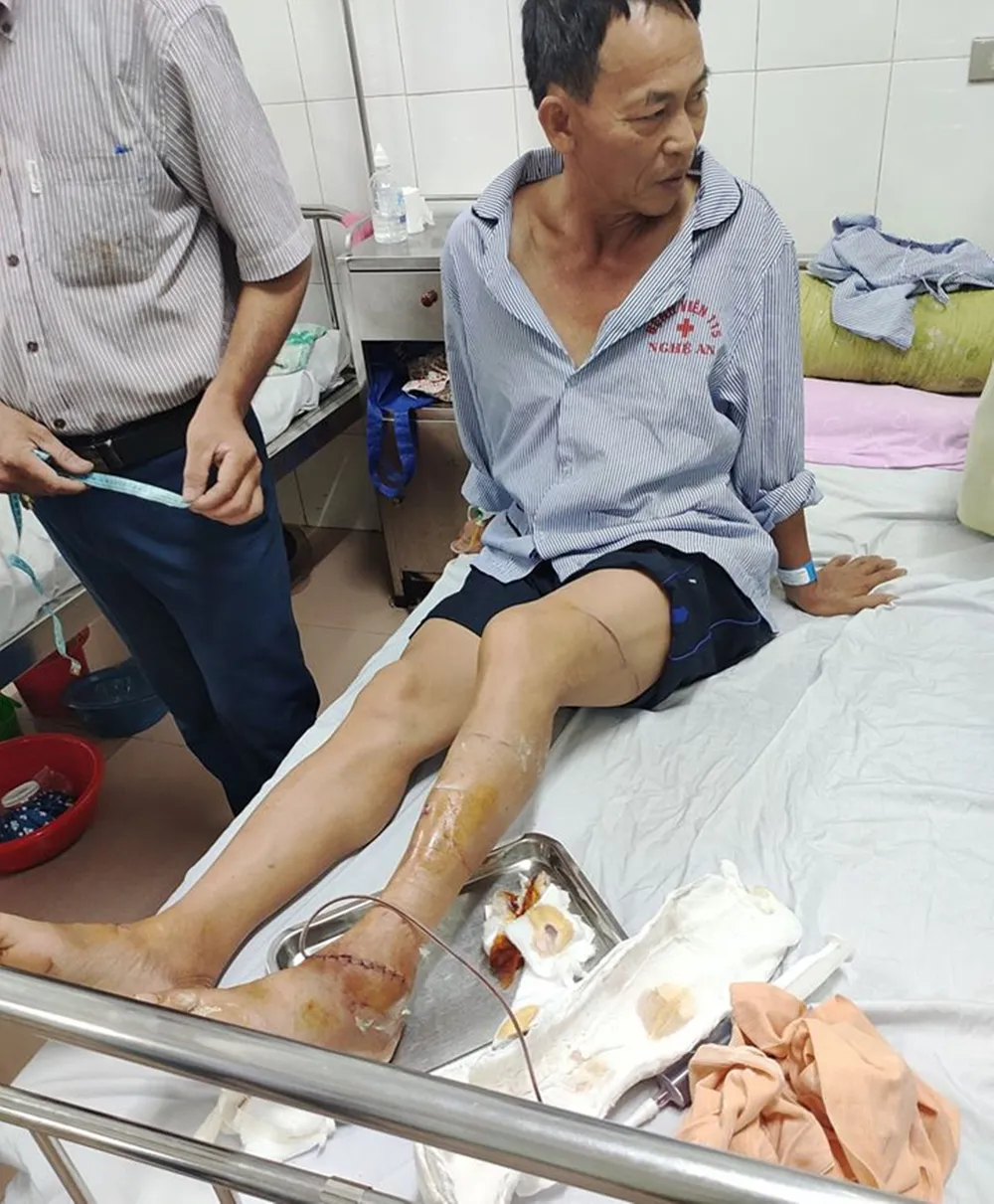 Khởi tố 2 anh em ruột về hành vi chống người thi hành công vụ ảnh 1