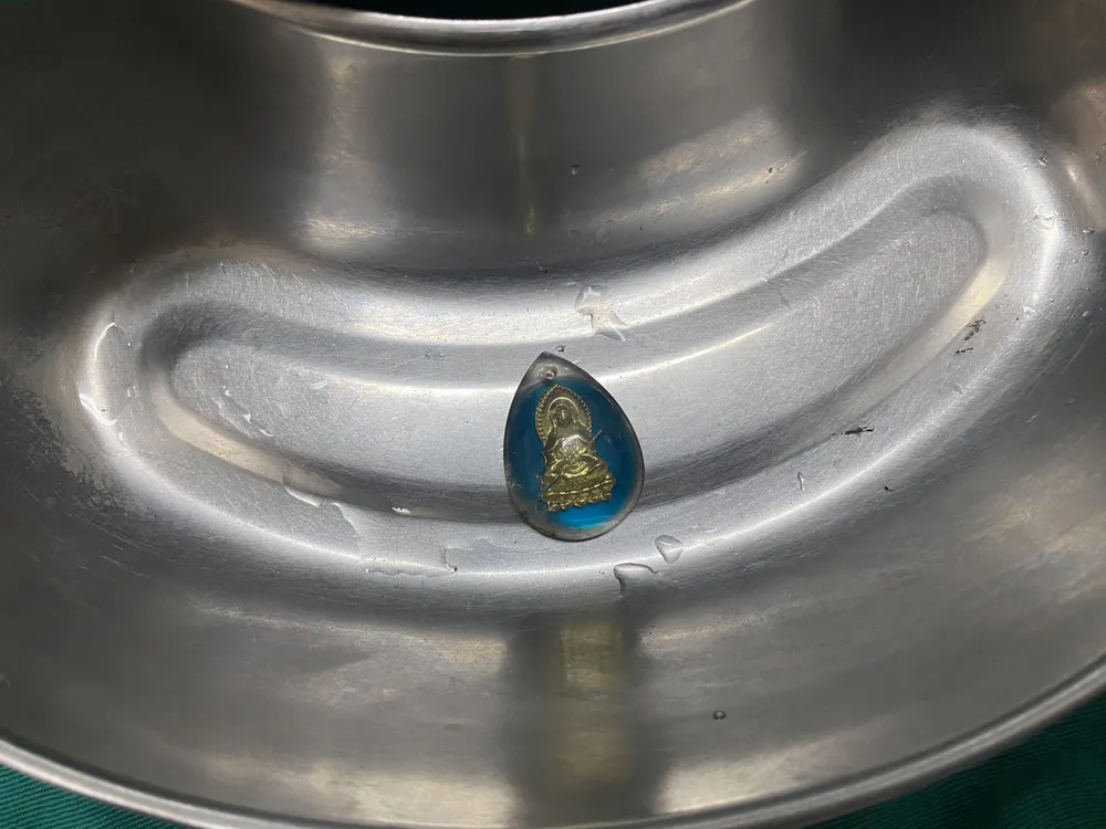 Hà Tĩnh: Gắp thành công mặt dây chuyền trong dạ dày bệnh nhân 2 tuổi ảnh 2