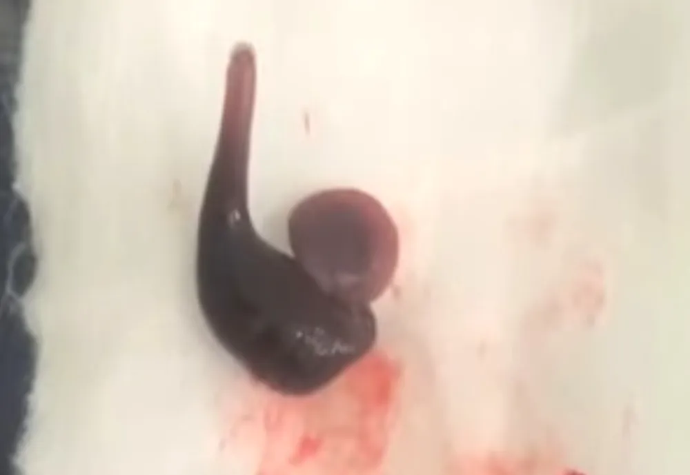 Con vắt đã được lấy ra ngoài 