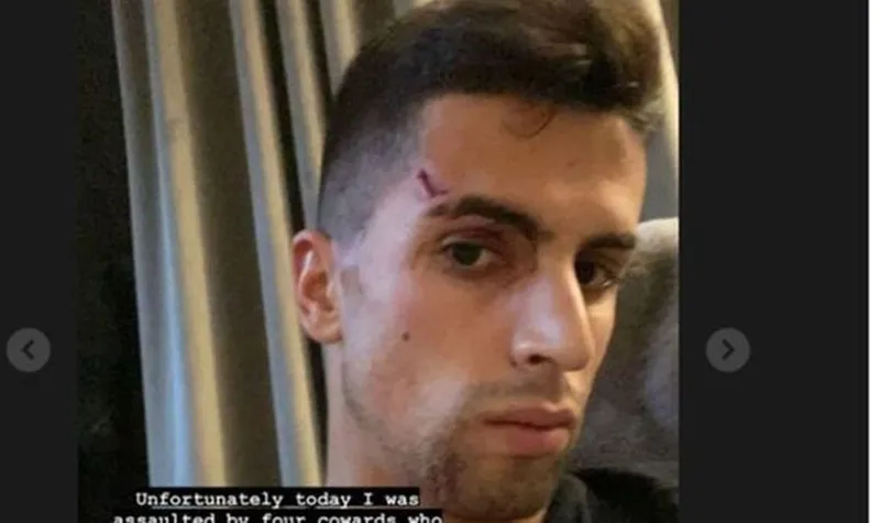 Sao Man.City bị thương khi trộm tấn công nhà ảnh 1