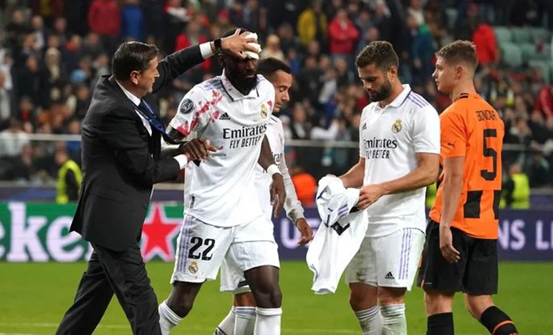 Rudiger đổ máu để “lấy vé” sớm cho Real Madrid ảnh 1