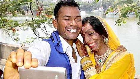 Đám cưới người bị tạt axít