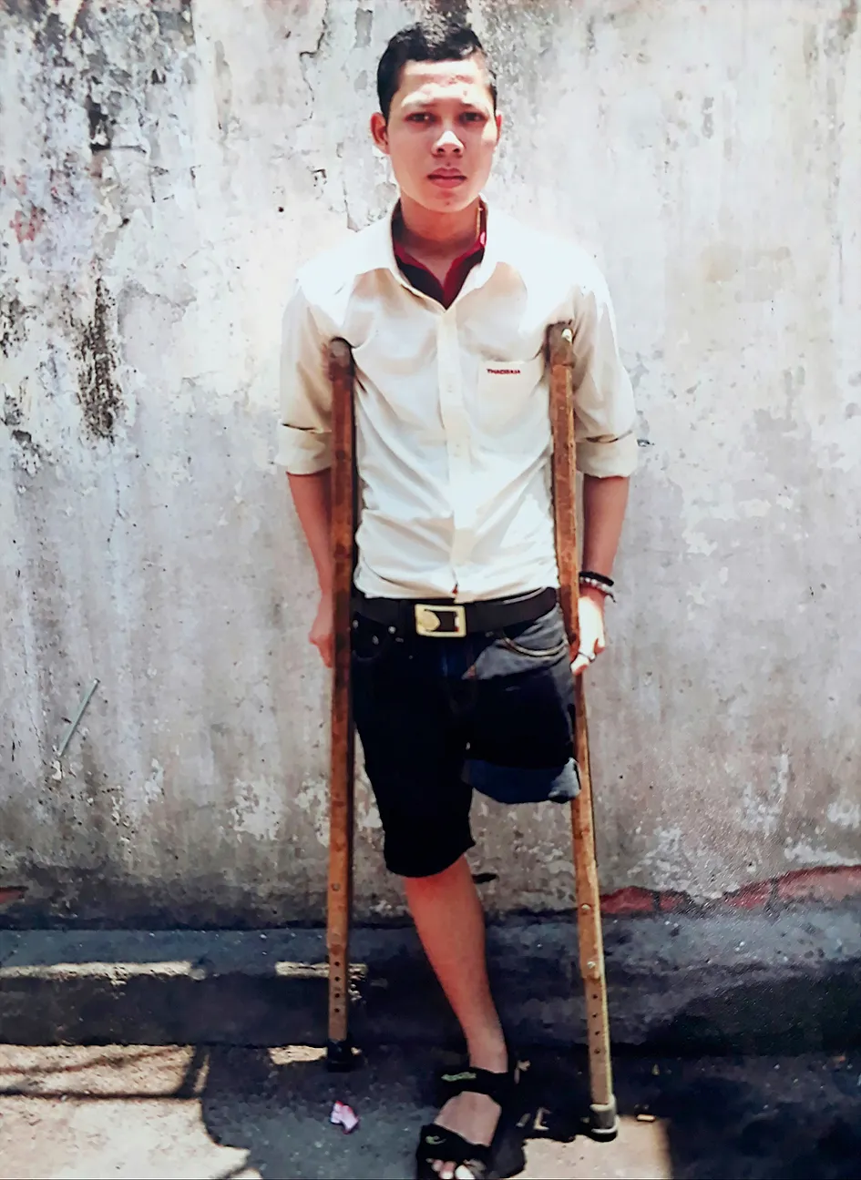 Nam sinh bị đoạn chi ước mong học hết cấp 3 ảnh 1