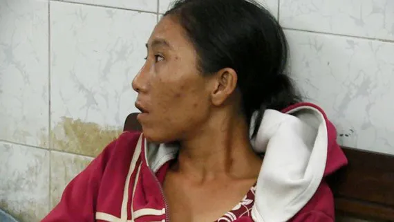 Đôi nam nữ lạm dụng trẻ em xin tiền mua ma túy bị đưa đi cai nghiện bắt buộc ảnh 1