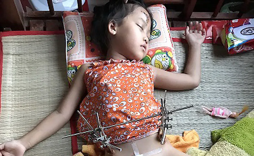 Gia đình nghèo gặp nạn thương tâm ảnh 1