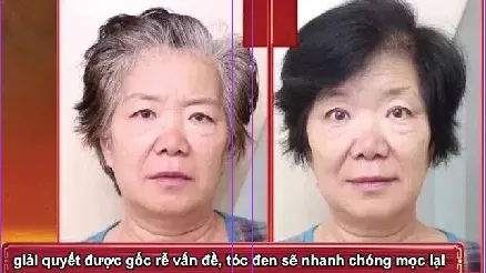 Tóc bạc 10 năm biến thành tóc đen, trị tóc bạc tận gốc, giúp tóc đen mọc trở lại!