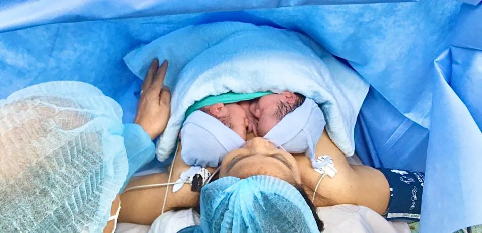 Cặp song sinh chào đời khỏe mạnh đang thực hiện da kề da với mẹ Cặp song sinh chào đời khỏe mạnh đang thực hiện da kề da với mẹ