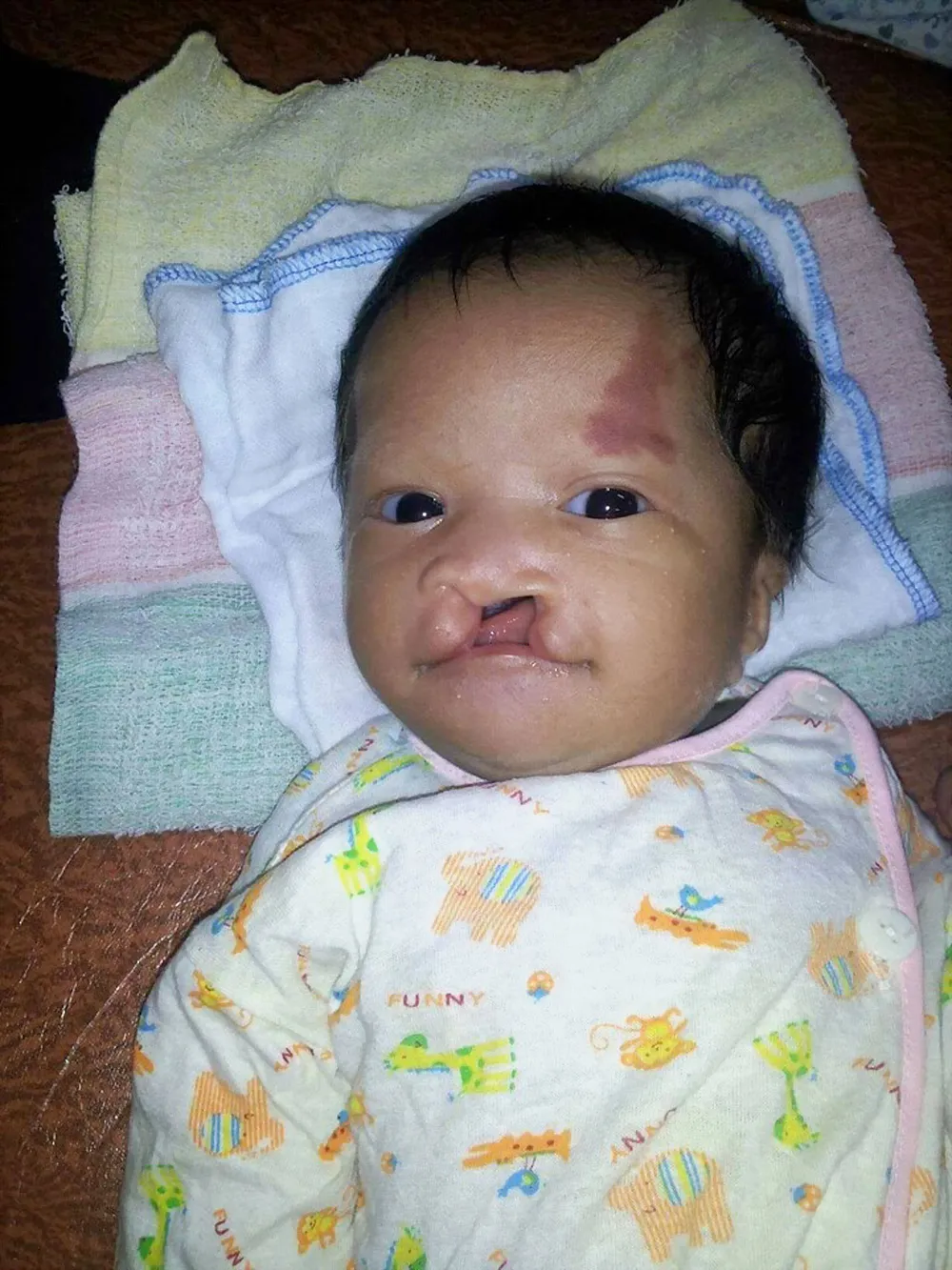 Bé sơ sinh mắc bệnh hiểm nghèo ảnh 1