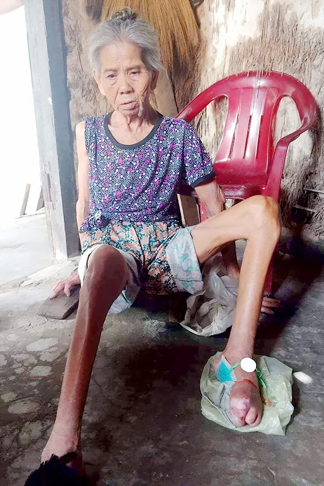 Cụ bà bị liệt chăm chồng gãy chân ảnh 1
