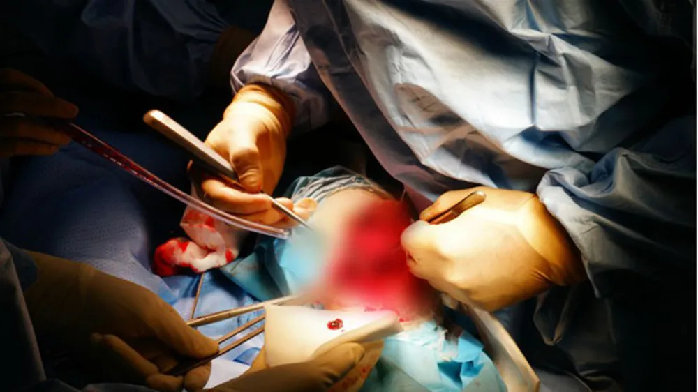 Bác sĩ thực hiện ca phẫu thuật "không truyền máu" cho người bệnh
