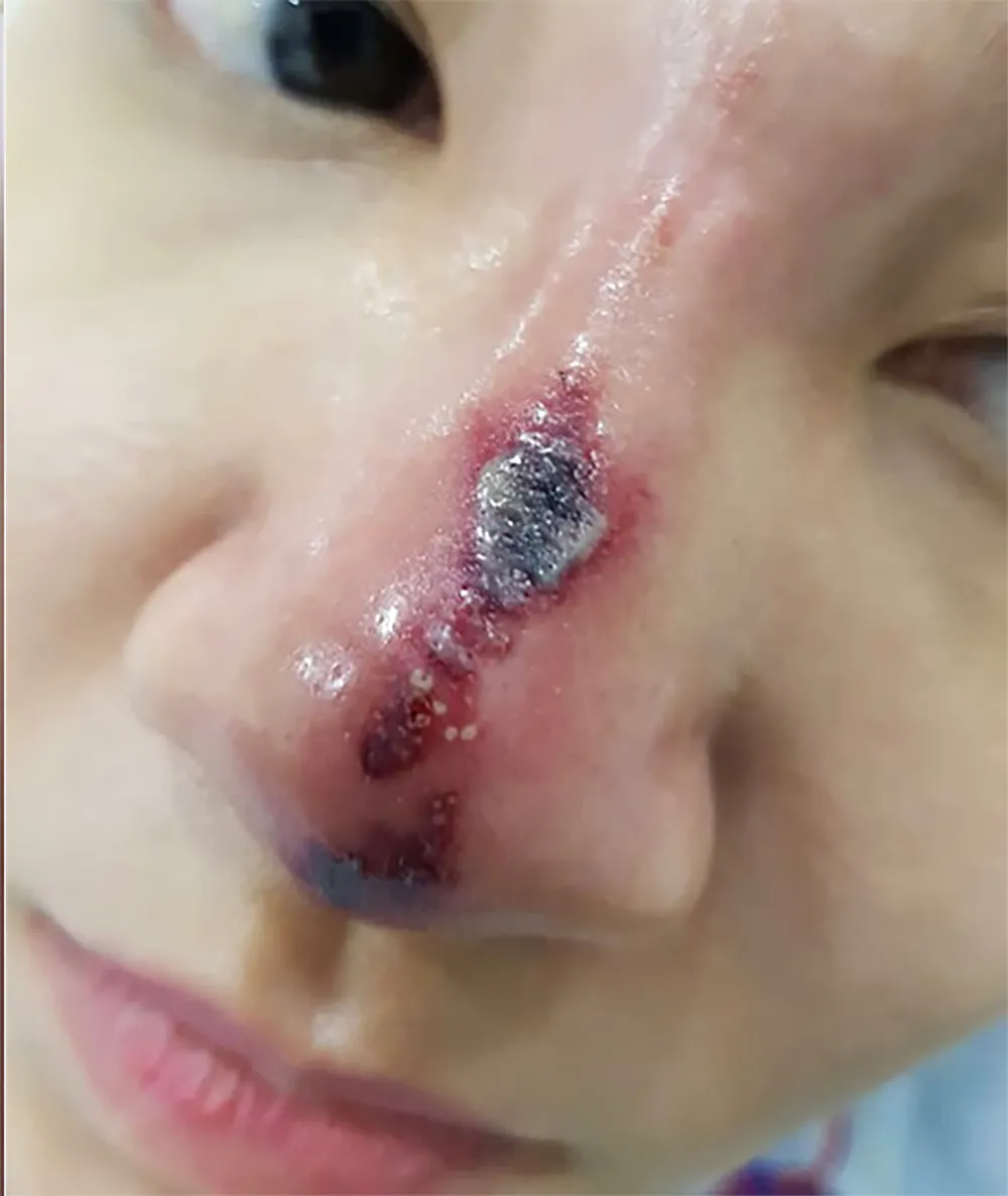 Làm đẹp đón tết: Coi chừng rước họa ảnh 2