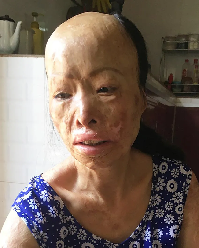 Người phụ nữ 10 năm sống trong sợ hãi ảnh 1