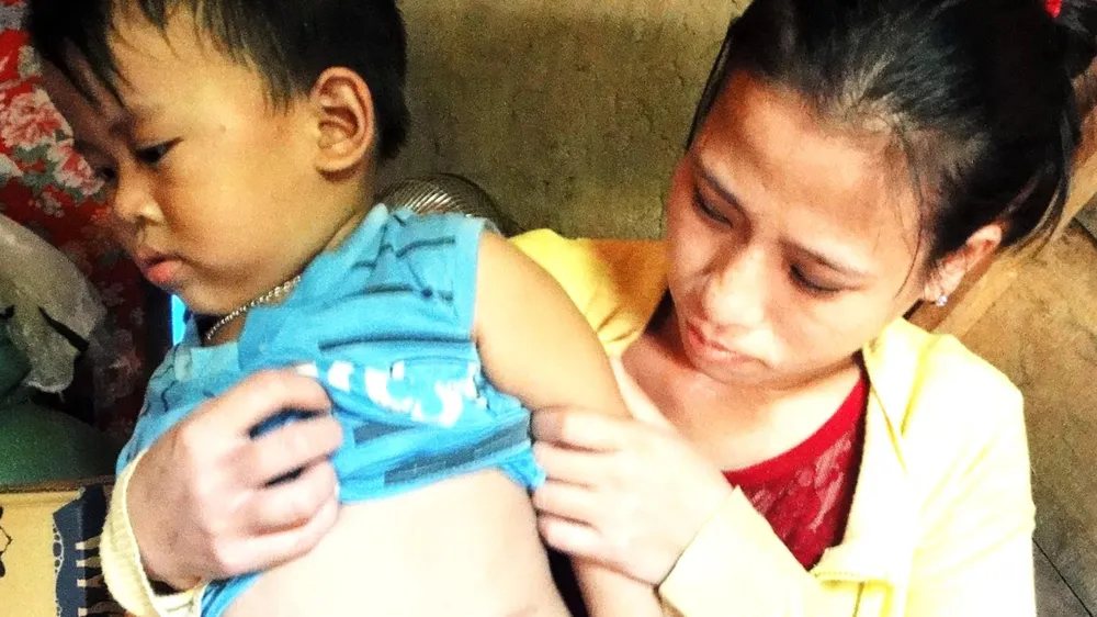 Mới 3 tuổi, 2 lần phẫu thuật ảnh 1