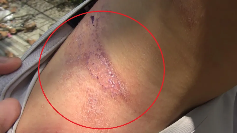 Mùa mưa đến, cẩn trọng với kiến ba khoang ảnh 1