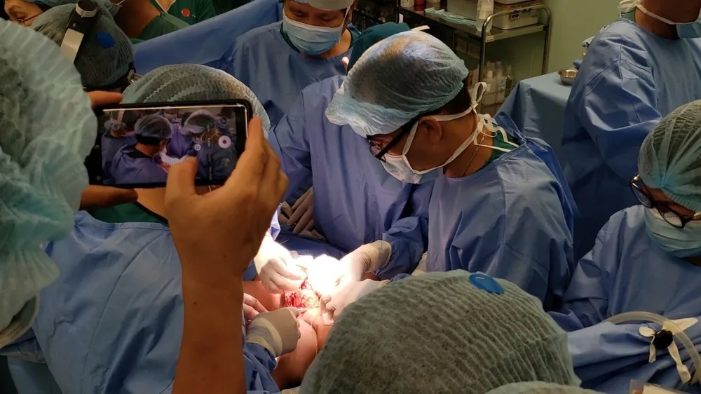 Trúc Nhi - Diệu Nhi được đưa ra khỏi phòng mổ ảnh 8