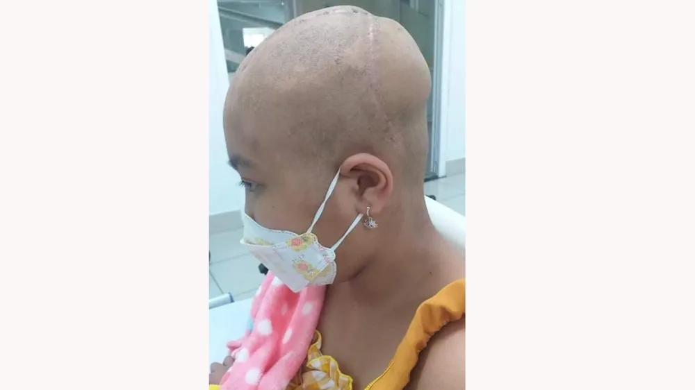 Bé Như Ý đang điều trị  tại Bệnh viện  Trung ương Huế