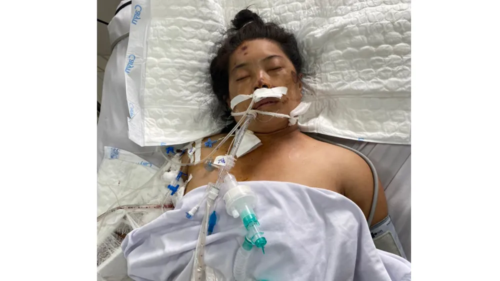 Chị Nguyễn Thị Hoạt hôn mê sâu sau tai nạn