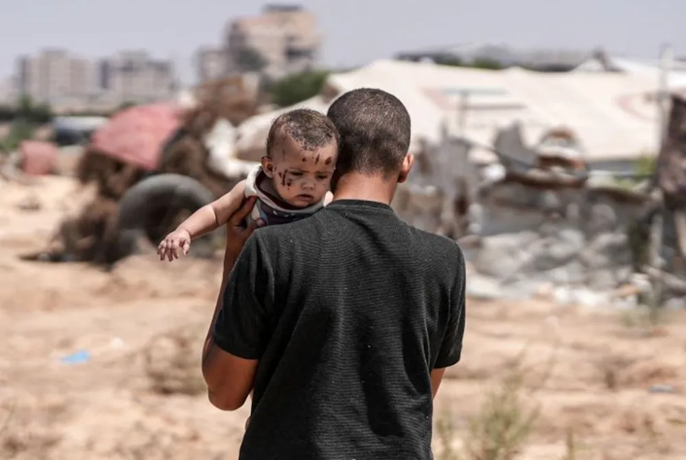 Em bé ba tháng tuổi Rim là người duy nhất sống sót sau cuộc tấn công của quân đội Israel vào nhà của gia đình Abu Hiyye ở Khan Yunis, Gaza. Ảnh / Getty Image.