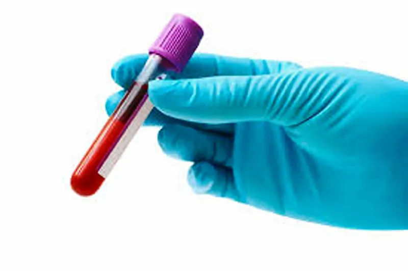 Sàng lọc ADN xét nghiệm ung thư