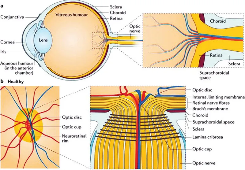 Phát hiện 40 chuỗi ADN mới gây bệnh tăng nhãn áp