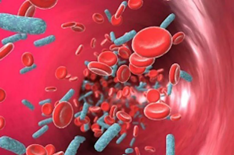 Nhiễm trùng huyết gia tăng ở Anh