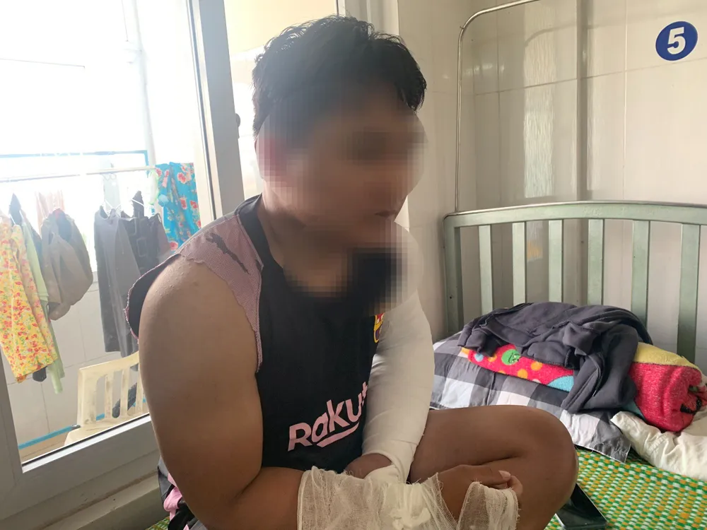 Anh L.A.Đ. (24 tuổi, trú huyện Nghĩa Hành, tỉnh Quảng Ngãi) bị đánh gãy 2 tay