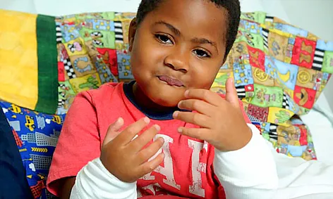 Ghép thành công đôi bàn tay