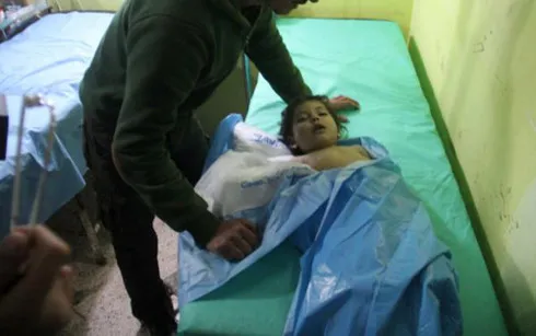Một em nhỏ được điều trị vì ảnh hưởng của vũ khí hóa học trong vụ tấn công khả Khan Sheikhun, Syria, tháng 4-2017. Ảnh: UPI