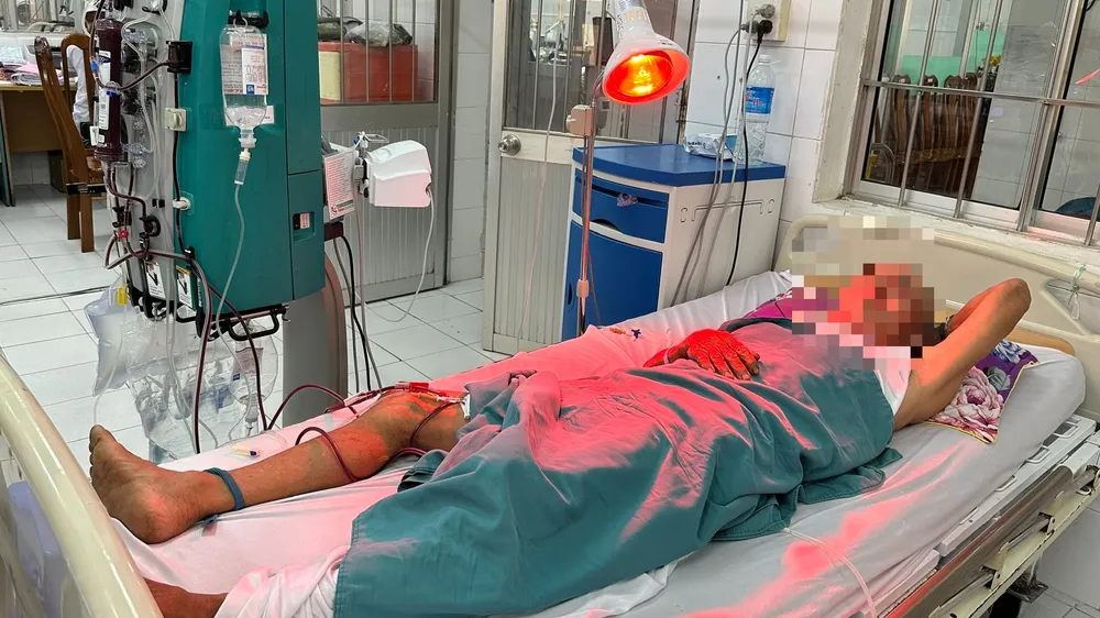 Một trong những bệnh nhân bị ngộ độc rượu đang điều trị tại Bệnh viện Đa khoa Cà Mau