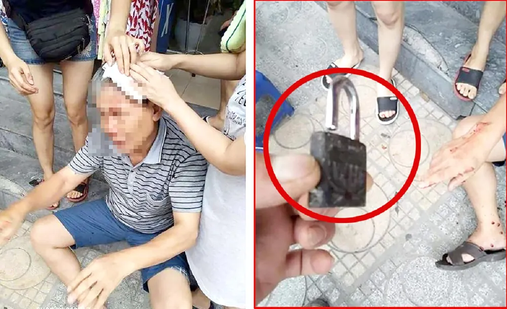 Cụ ông khoảng 70 tuổi bất ngờ bị ổ khóa rơi từ tầng cao chung cư xuống trúng đầu, chảy máu khá nhiều