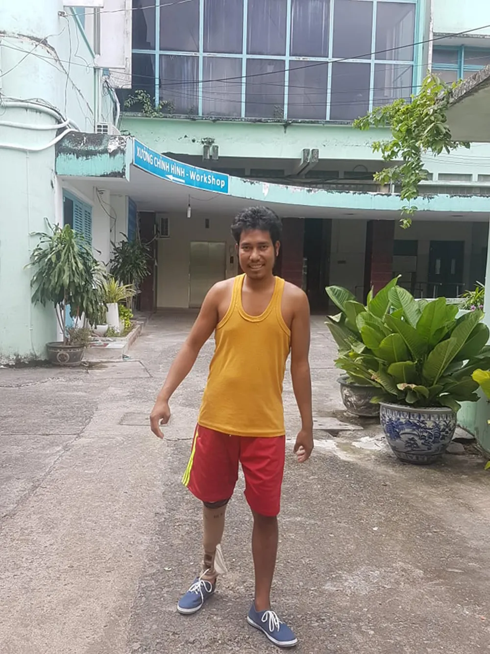 Chiếc chân giả ấm tình người ảnh 1