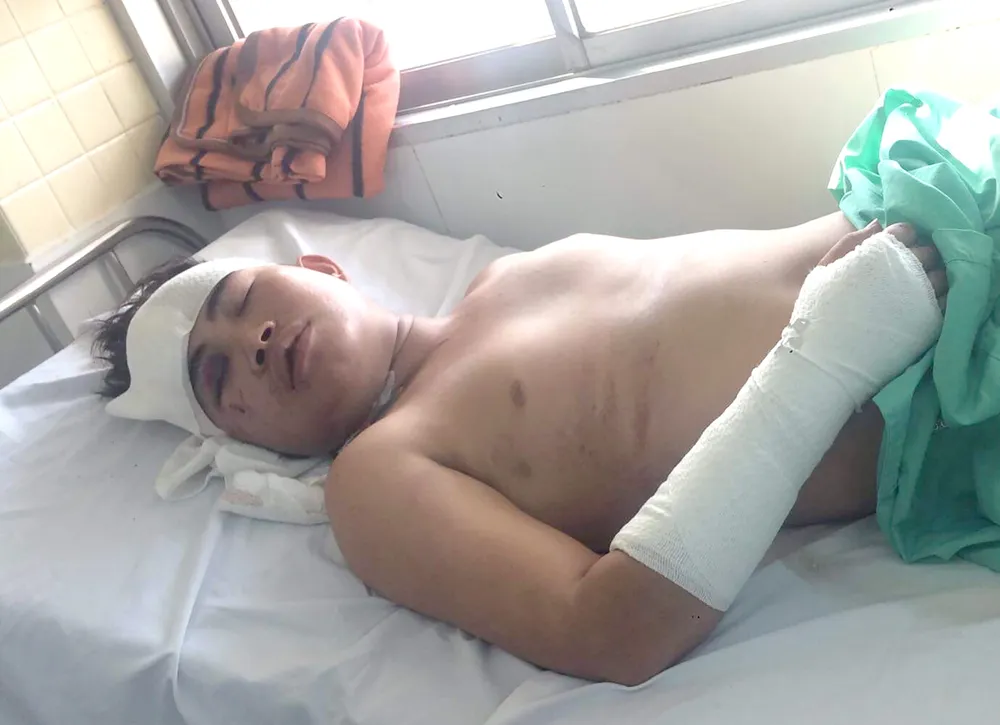 Thanh niên nghèo, mồ côi bị tai nạn giao thông ảnh 1