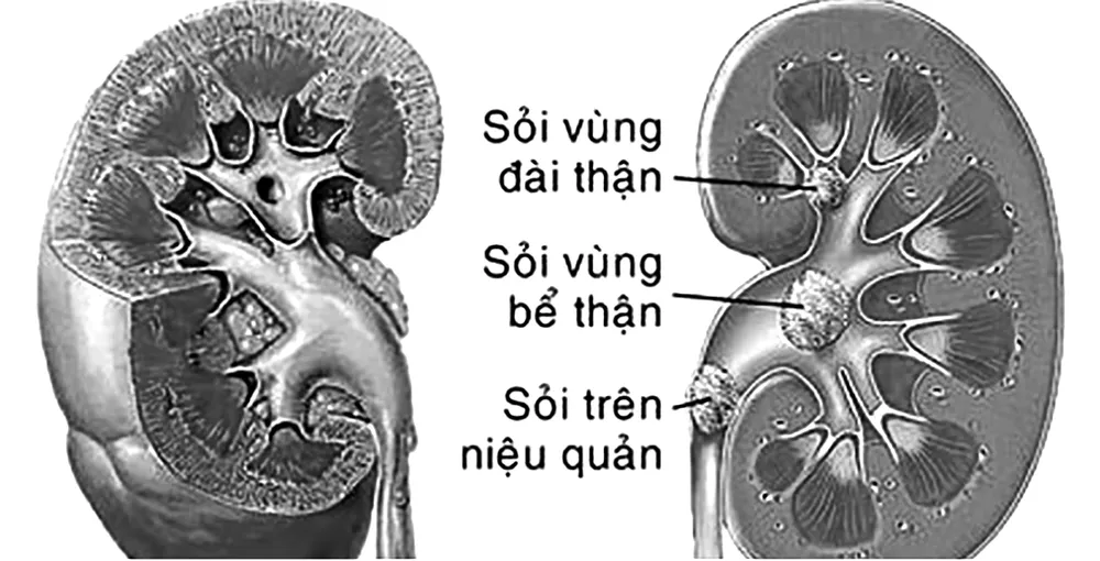 Ảnh minh họa: Nguồn Internet