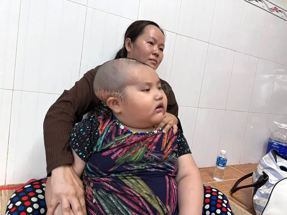 Nhà nghèo, con bị chấn thương sọ não ảnh 1