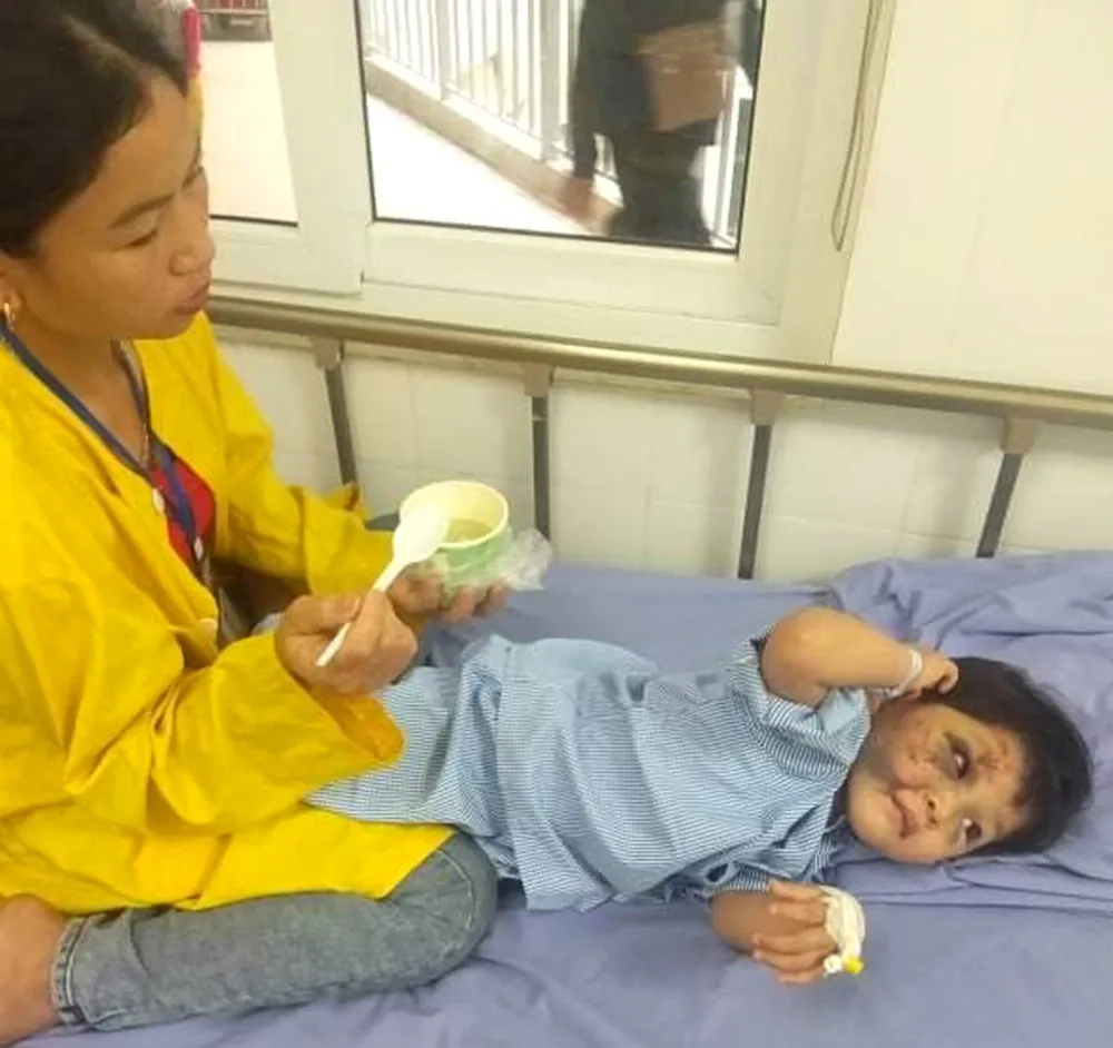 Chồng bệnh, con bị tai nạn vỡ xương mặt ảnh 1