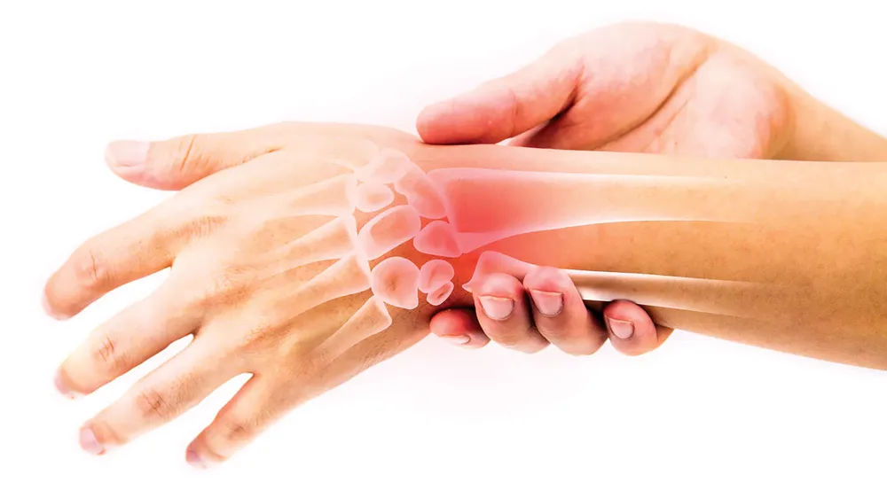 Đừng chủ quan hội chứng ống cổ tay ảnh 2