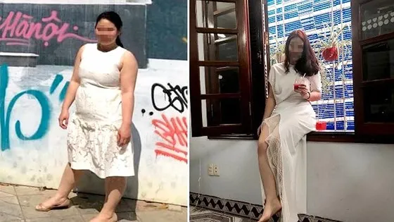 'Vũ khí' mới khắc chế béo phì ảnh 1