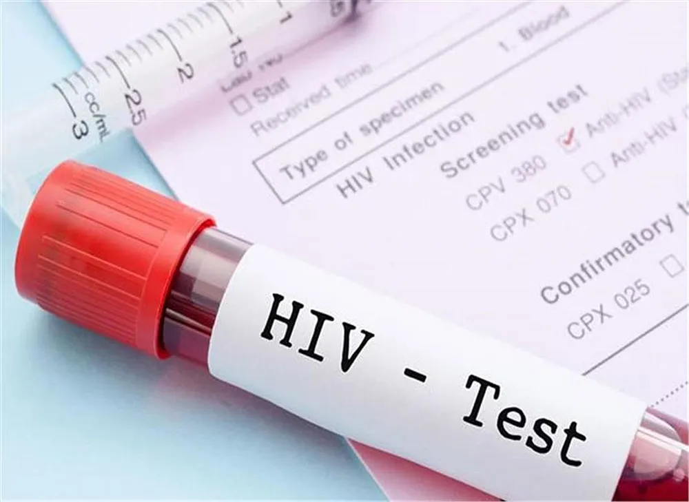 Thử nghiệm thành công giai đoạn đầu vaccine mới phòng HIV/AIDS ảnh 1