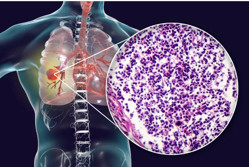 Ảnh minh họa. Ảnh: GETTY IMAGES 